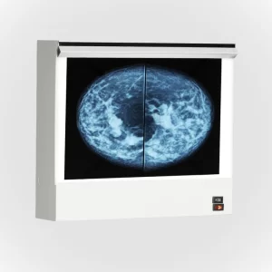 VuPlus Mammography Viewer