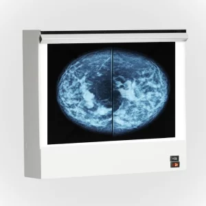 VuPlus Mammography Viewer
